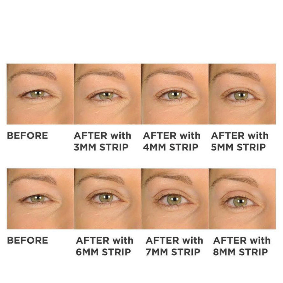 Contour RX Eyelid Lifting Strips