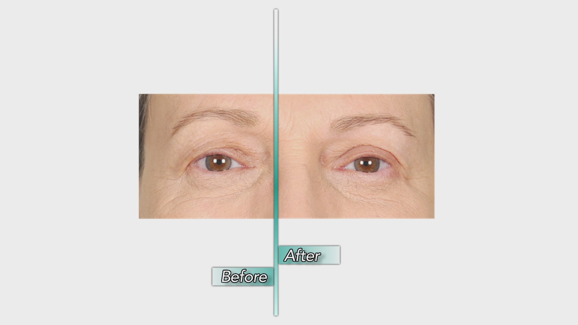 Contours rx Before and After