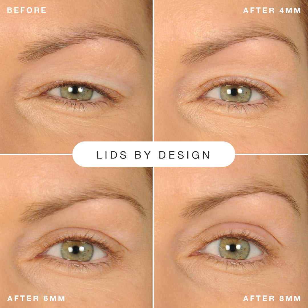 Lids by Design - 80 Cosmetic Strips